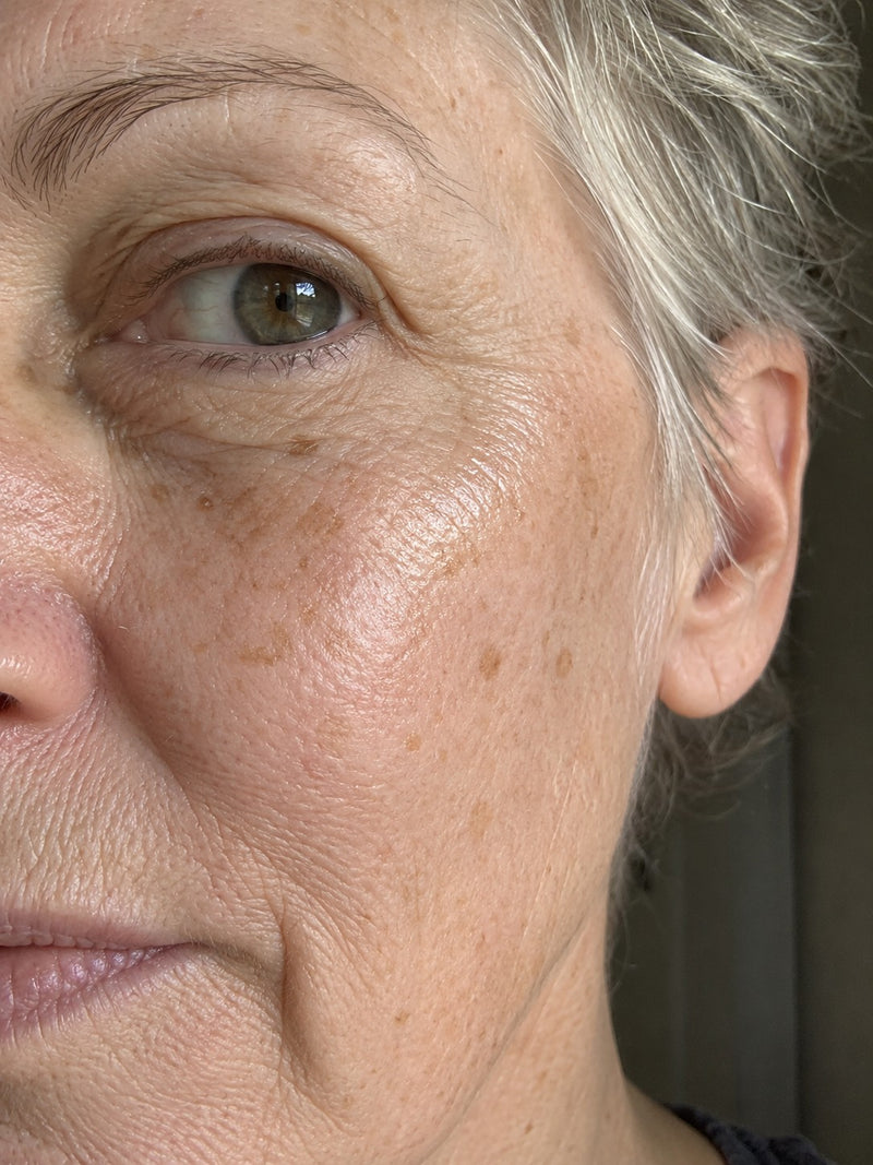 Dewy skin after using the pen